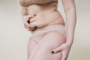 tummy tuck